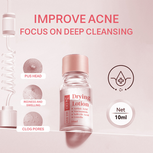 50% Korting!🧴 Salicylzuur Spot Drying Lotion – Dubbellaagse Formule voor Snel Verwijderen van Puistjes 's Nachts!