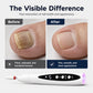 2-in-1 Elektrische Nagelfräse mit UV-Gellampe – Tragbares Maniküre- & Pediküre-Set