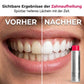 🦷✨ 50% RABATT! Professionelle Mundspülung zur Fleckenentfernung & Zahnaufhellung – Für ein strahlend weißes Lächeln in 1 Woche 💎